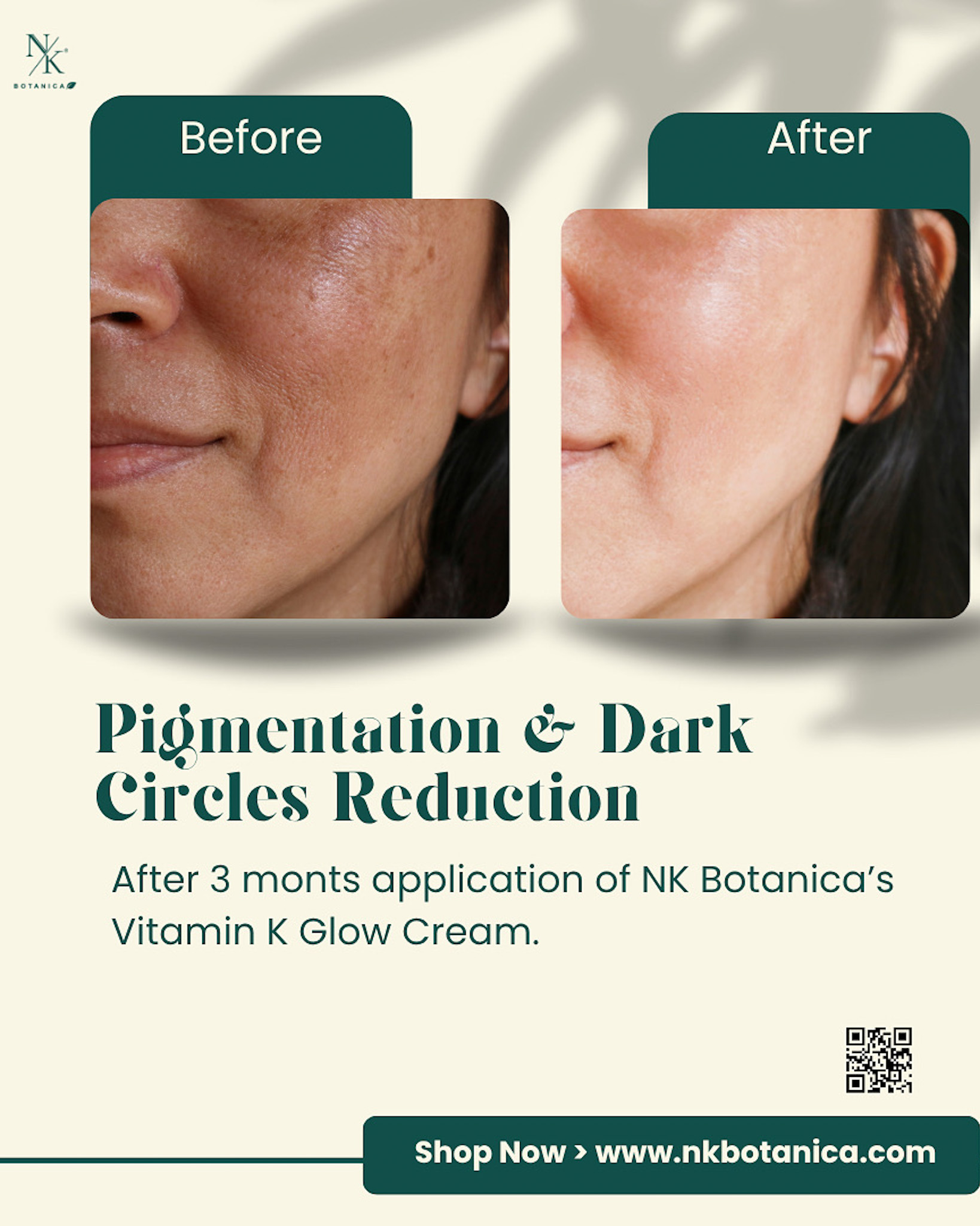 What does vitamin-K do for your skin Science behind Dark circles