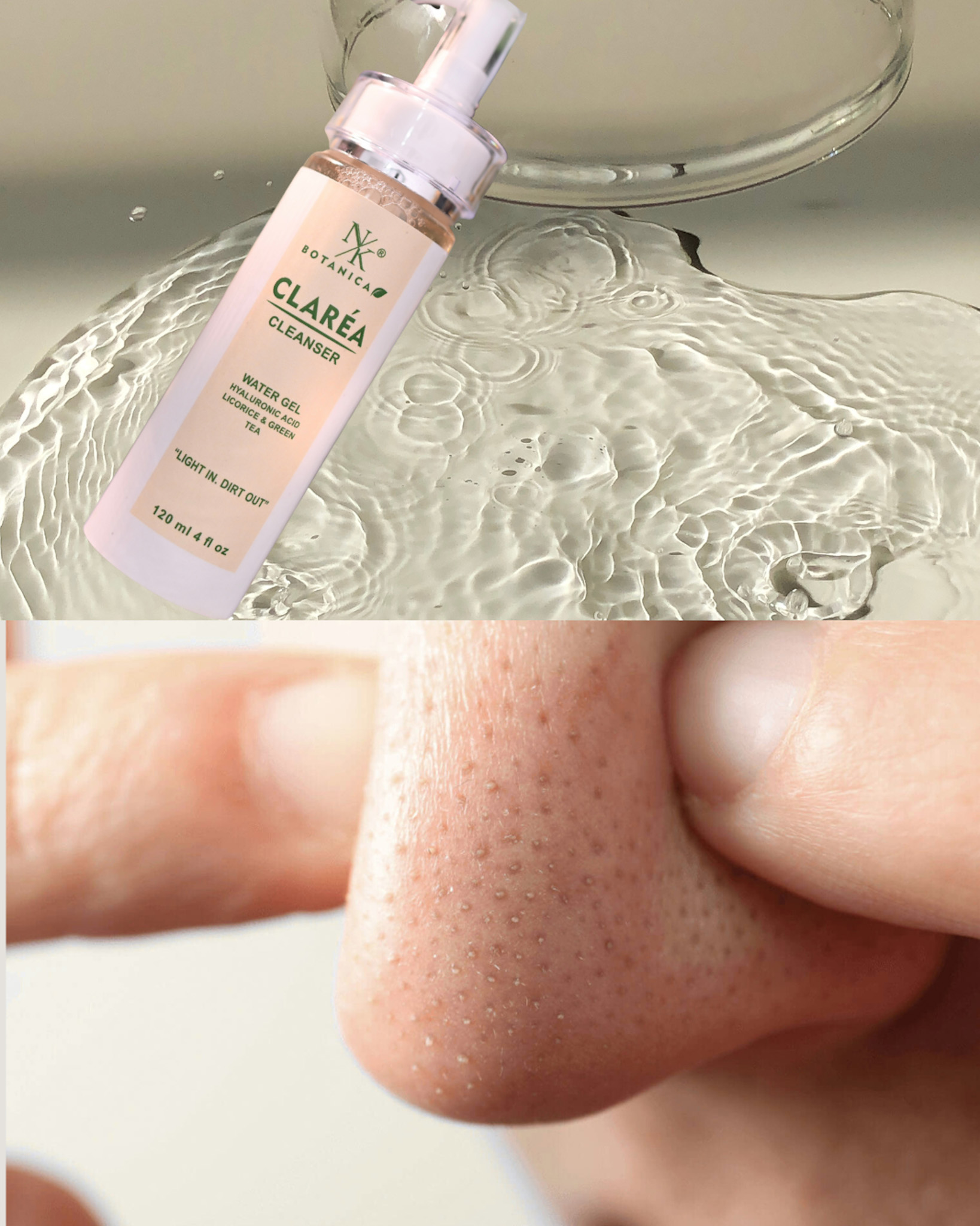 Blackhead and Whiteheads The Ultimate Guide to Clear Skin in Pakistan