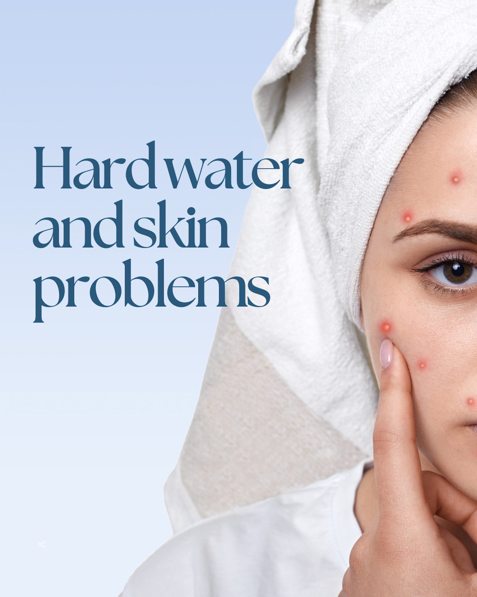 Hard Water & Skin Problems in Pakistan – Causes & Solutions