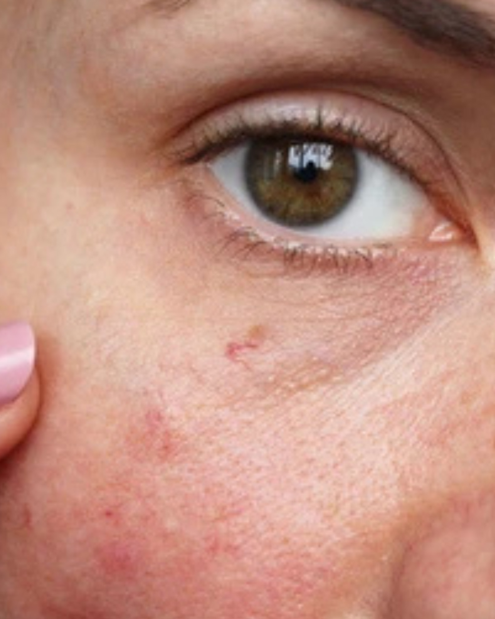 Why You Should Try an Overnight Balm